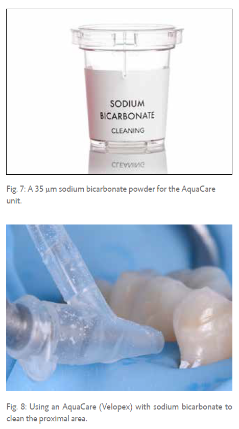Fig. 7: A 35  m sodium bicarbonate powder for the AquaCare unit.   Fig. 8: Using an AquaCare (Velopex) with sodium bicarbonate to clean the proximal area.